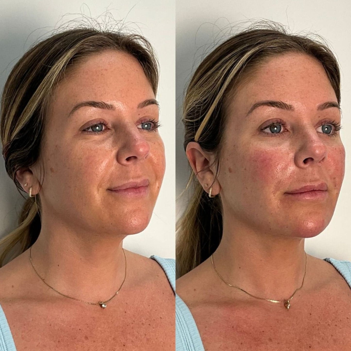 Roote® Koreanisches Seiden-Peptid Serum