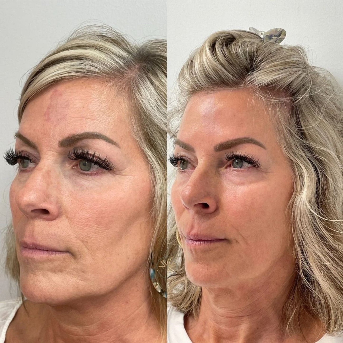 Roote® Koreanisches Seiden-Peptid Serum